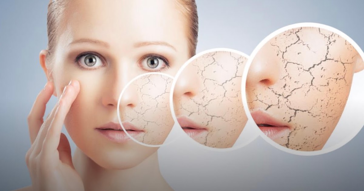 Dermatite Péri Orale Causes, Solutions, Remèdes ? Point sur L