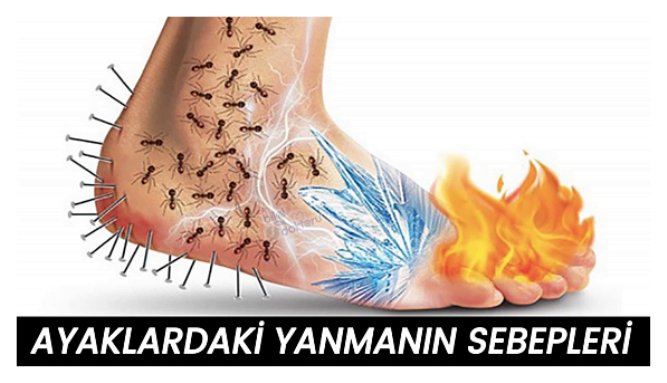 ayaklarda yanma neden olur ayak