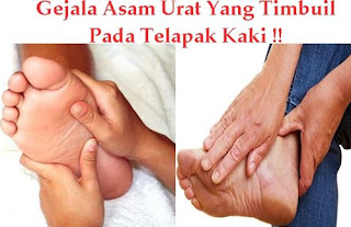 asam urat makan timun, gejala asam urat pada bahu, mengobati asam urat kaki, asam urat di pergelangan kaki, normal asam urat dan kolesterol, pantangan bagi penderita asam urat news, asam urat batu ginjal, obat paten untuk menurunkan asam urat, sayuran pantangan asam urat, obat asam urat kambuh, obat asam urat yang sudah akut, apakah asam urat bisa dibekam, obat asam urat yang berbahaya, cek lab asam urat, bolehkah penderita asam urat makan cincau, resep tradisional untuk mengobati asam urat, gejala asam urat dan obat herbalnya, asam urat makanan dihindari, ciri asam urat pada tubuh, obat alami obati asam urat, asam urat gatal, cek asam urat setelah makan, mengobati asam urat untuk ibu hamil, nilai normal kadar asam urat menurut who, cara untuk mengatasi penyakit asam urat, obat alami buat sakit asam urat, obat asam urat dosis rendah, mengurangi asam urat darah, mengobati asam urat dengan tanaman, obat alternatif sakit asam urat