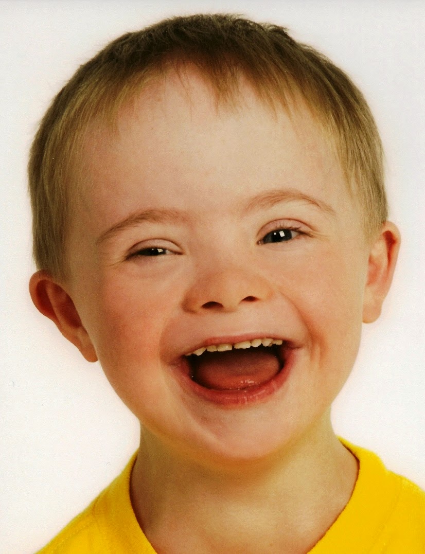 Фотография дауна. Мальчик улыбается. Ребенок улыбается. Лицо Дауна. Синдром Дауна.