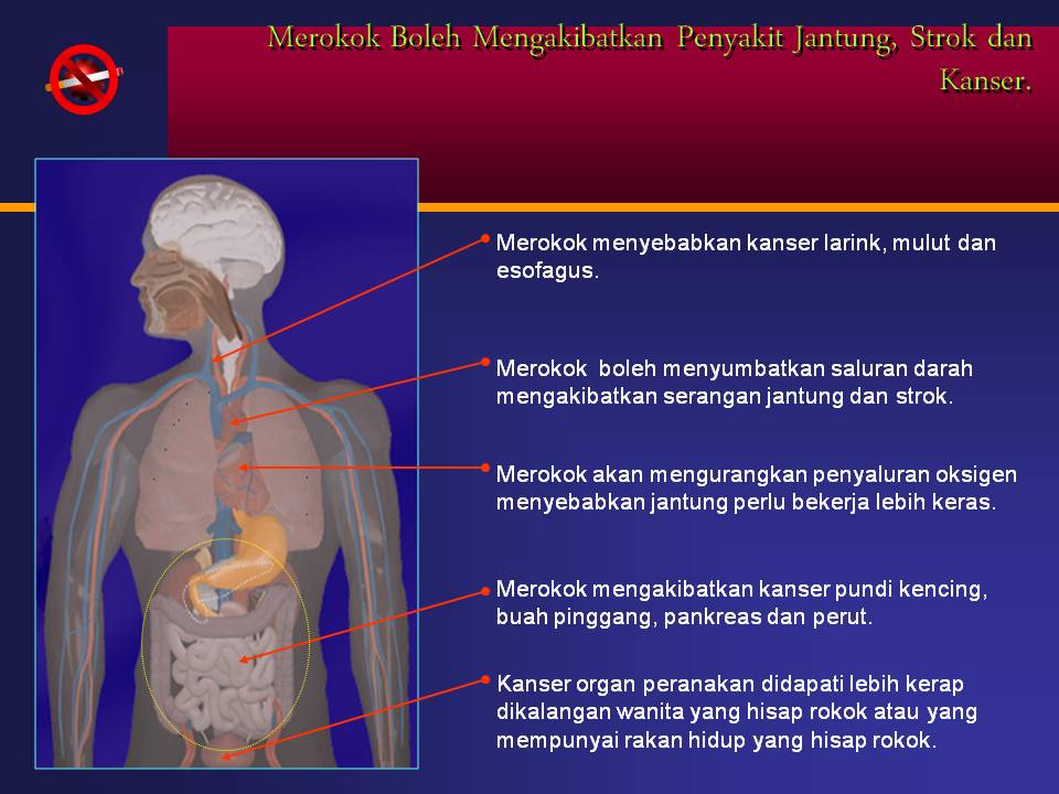 Kami Bestari Tanpa Dadah: KANDUNGAN RACUN BERBAHAYA DALAM ROKOK DAN KESANNYA KE ATAS TUBUH BADAN 