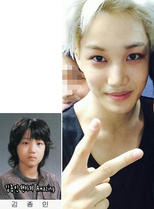 얼굴 부어서 한쪽 쌍커풀라인 사라진 엑소 카이 | 인스티즈