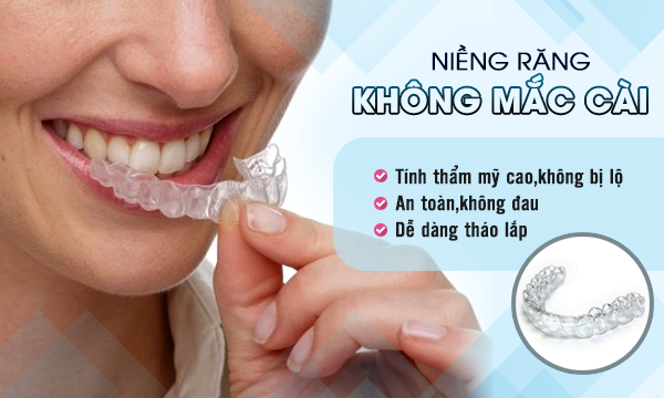 Khay niềng răng Invisalign