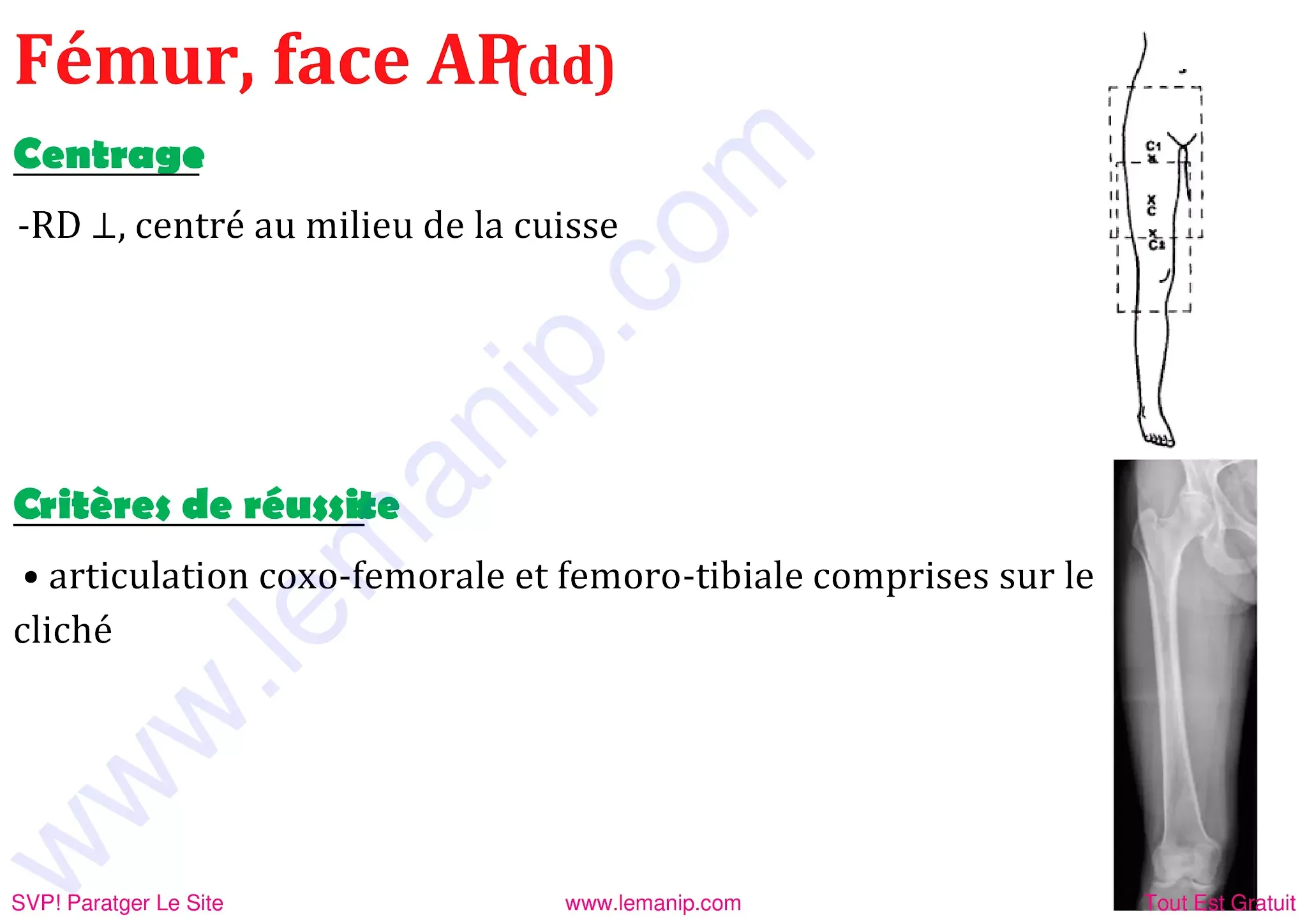 Femur de face