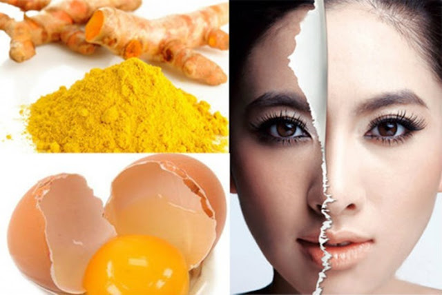 Mẹo trị nám bằng trắng gà hiệu quả chỉ sau 7 ngày Mẹo trị nám bằng trắng gà hiệu quả chỉ sau 7 ngày