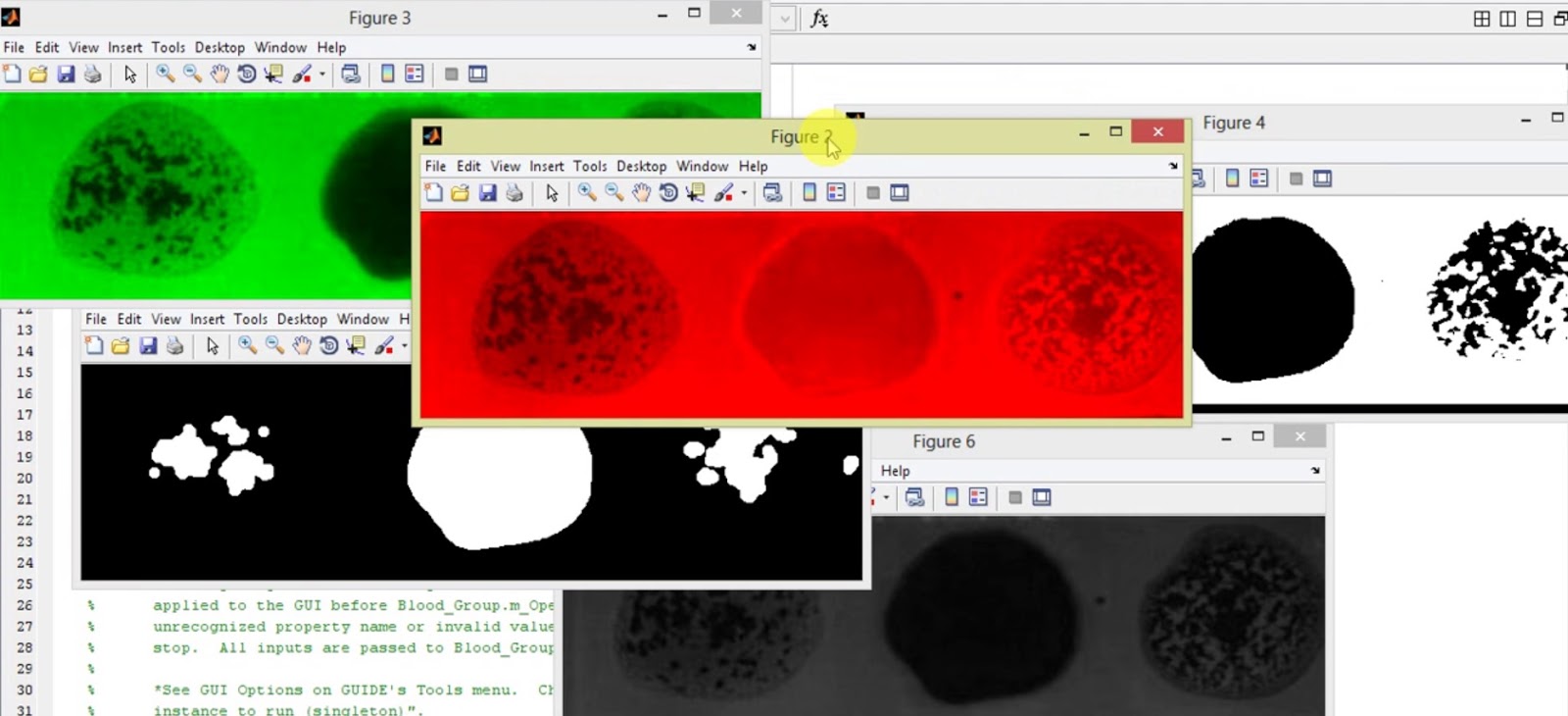 Blood Group Detection Using Image Processing Matlab Project Code ENGINEERING PROJECTS