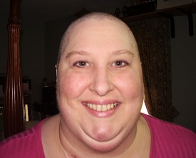 When I Lost My Hair To Chemo: 4/2011