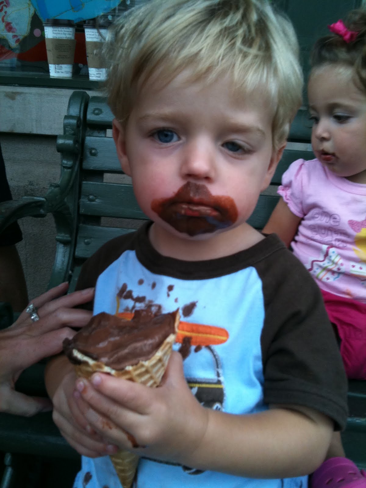 Congenital Ptosis Photos 12+ months after frontalis sling surgery