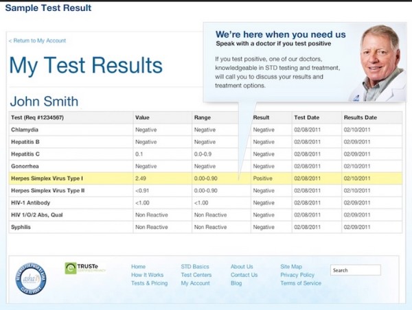 how-long-do-std-test-results-take