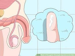 Antibiotik Untuk Gonore Cara Mencegah Penyakit Gonore Brainly Gus Penis Sakit Over Blog Com