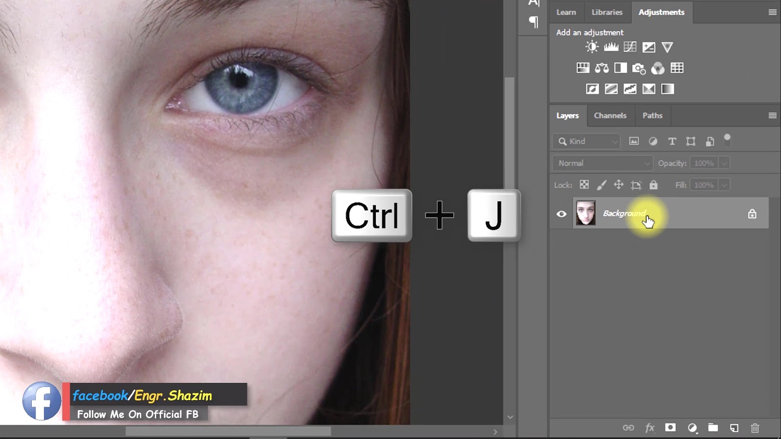 How to Remove Eye bags and Eye Dark Circle in
