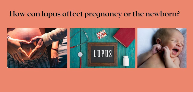 How can lupus affect pregnancy or the newborn?