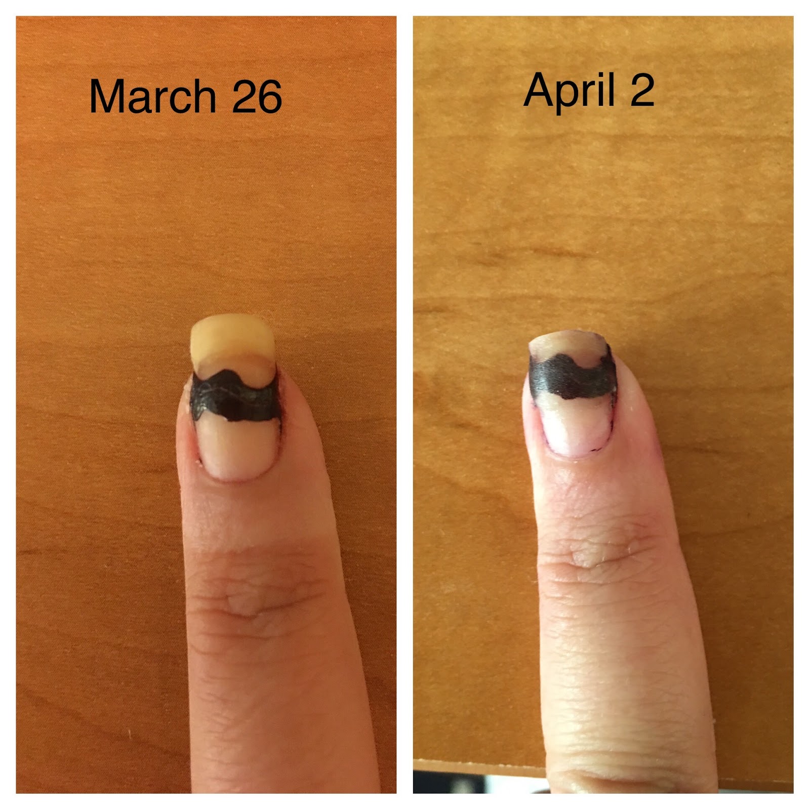 How to Save and Regrow Nails After a Break