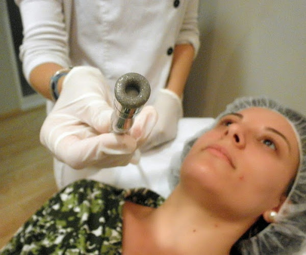 microdermoabrasión, punta de diamante, clinicas DH, Castellón