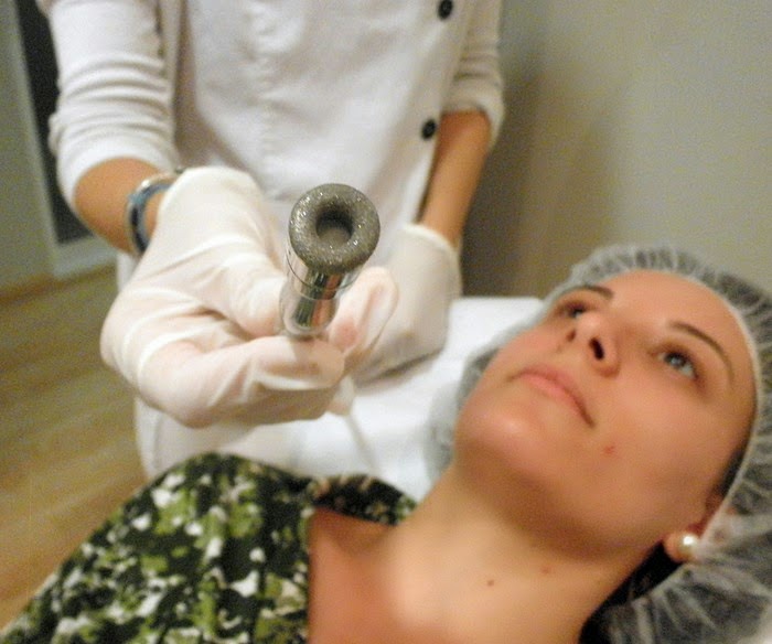 microdermoabrasión, punta de diamante, clinicas DH, Castellón