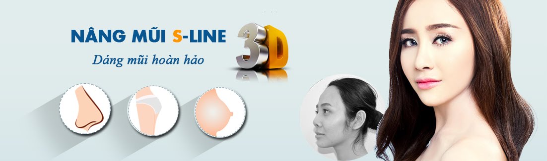 Sửa mũi s line 3D đẹp hoàn hảo