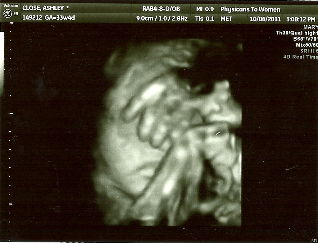 The ABC's of Life Where is that baby hiding? The ABC's of Life Where is that baby hiding?
