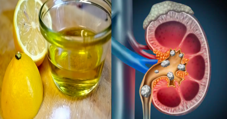 which diabetes meds are bad for kidneys