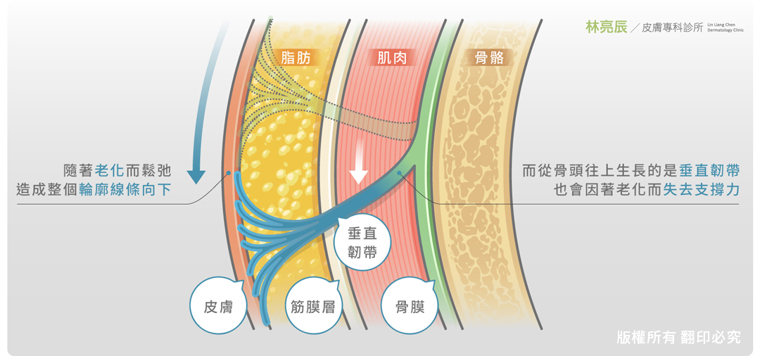 05-玻尿酸臉腫不自然sculptra舒顏萃液態拉皮童顏針價格效果按摩新竹聚左旋乳酸洢蓮絲ELLANSE新竹林亮辰醫師新竹皮膚科2