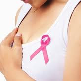 The Breast Cancer 