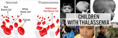 obat thalasemia alami