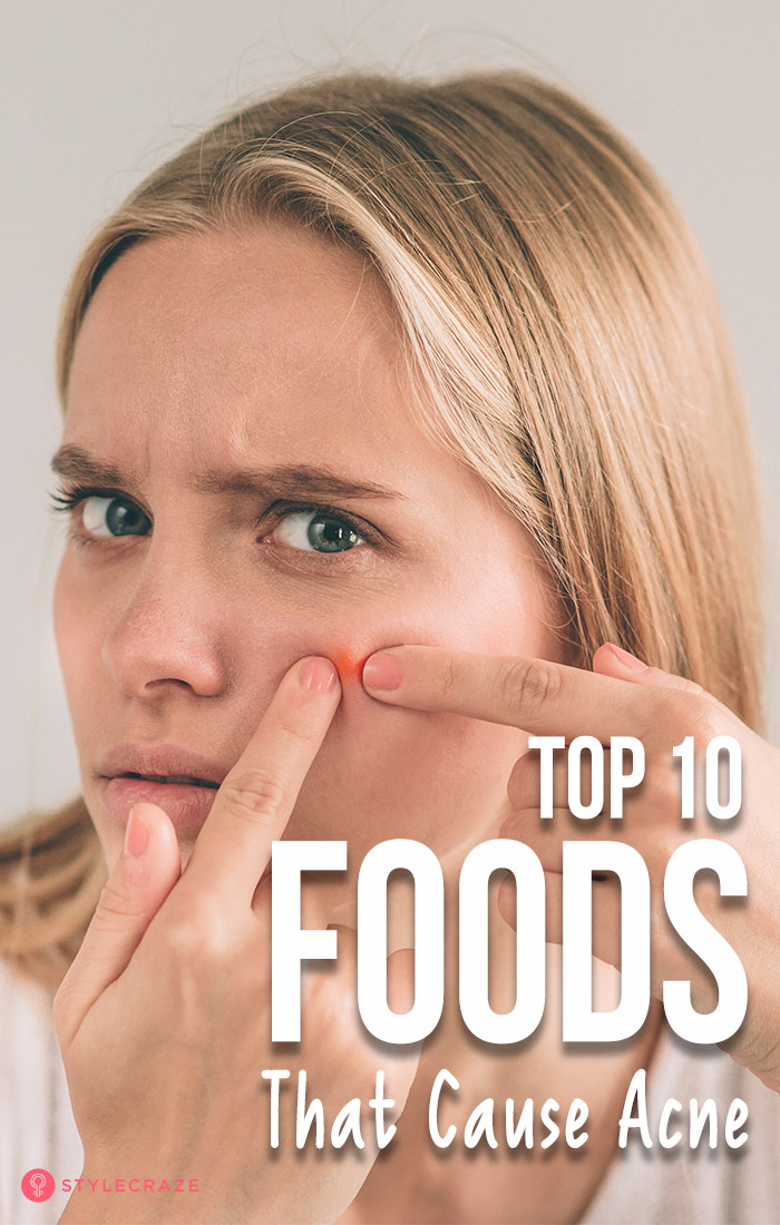 Top 10 Foods That Can Cause Acne