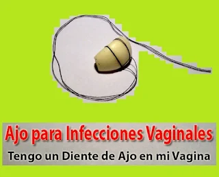  remedios-caseros-para-las-infecciones-vaginales-por-hongos-ajo
