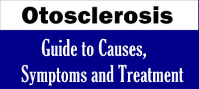 Otosclerosis - Guide to Causes, Symptoms and Treatment