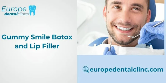 Gummy Smile Botox and Lip Filler - Europe Dental Clinic