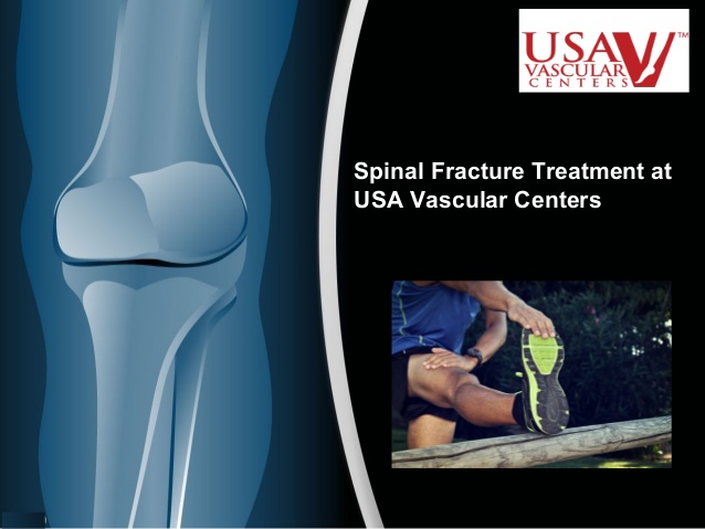 Spine Fracture Treatment California