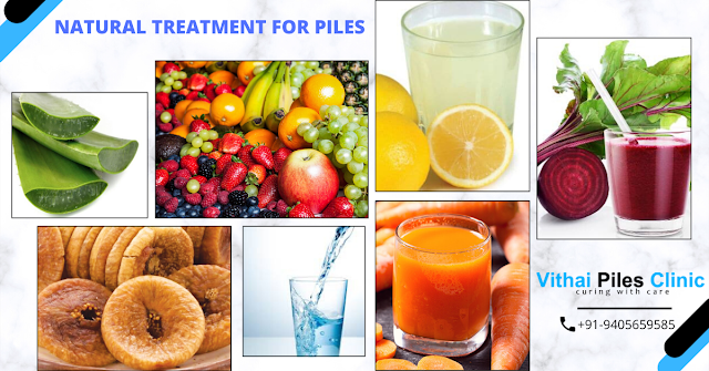 hemorrhoids, Piles, natural treatment for piles, Suffering From Piles, home treatments for piles, piles home treatment, piles home remedies food, how to cure hemorrhoids at home fast