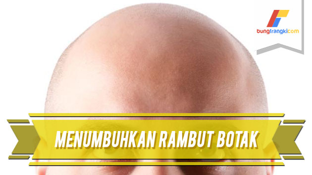 8 Cara Alami Menumbuhkan Rambut Botak