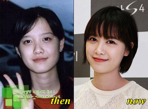 Ku Hye Sun Plastic Surgery Before and After | Kpop Plastic Surgery