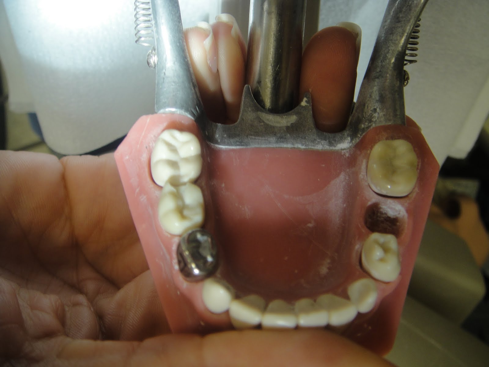 StuDENT Diaries Pedo Stainless Steel Crown