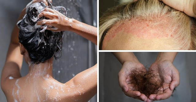 Ce que votre shampooing ne devrait pas avoir pour éviter la chute des cheveux
