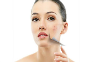 Burn Surgery In Lahore By the best plastic surgeon in lahore with optimal results