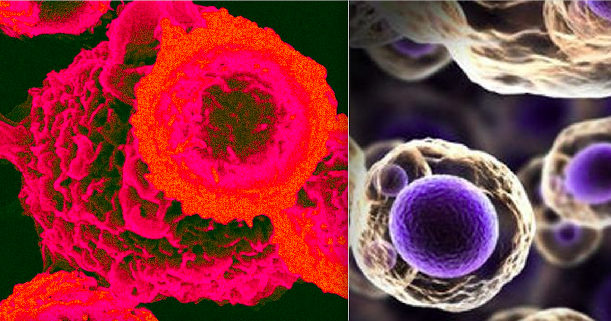 New Research Suggests That All Cancers Are Linked To A Single Protein New Research Suggests That All Cancers Are Linked To A Single Protein