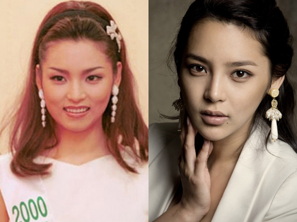 Perubahan Wajah Artis Korea Yang Operasi Plastik Berita Aneh Unik Dan Menarik