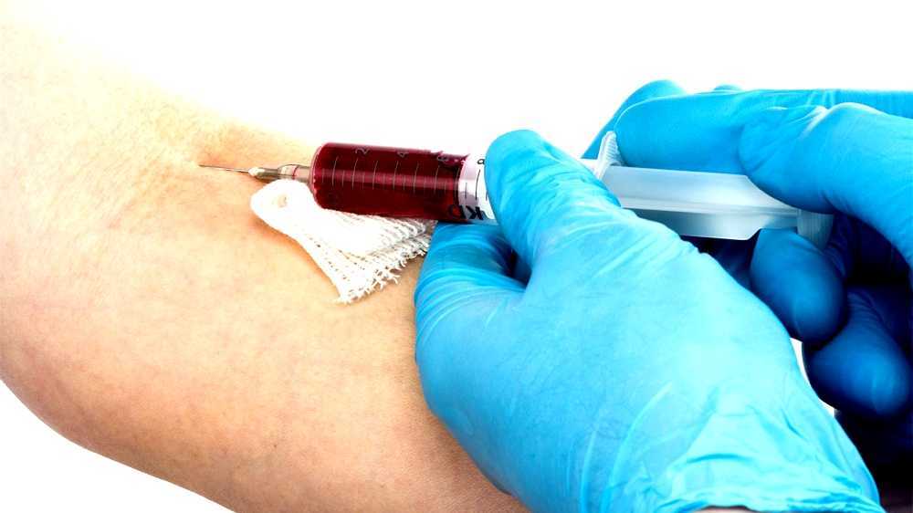 Venipuncture