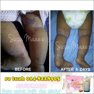 testimoni susu maaez belleza sofieya beauty