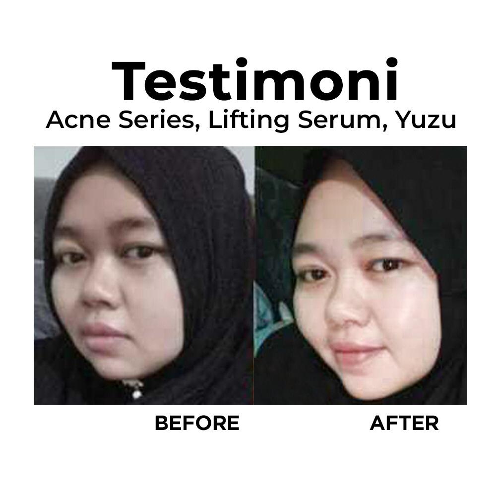 Testimoni Para Pengguna Produk Ms Glow