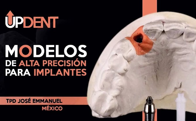 WEBINAR: Modelos de Alta Precisión para Implantes - TPD José Emmanuel Adame