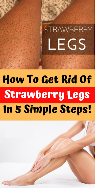How To Get Rid Of Strawberry Legs Health0medical