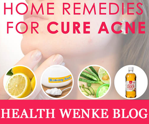 Top10 Quick Home Remedies To Cure Acne