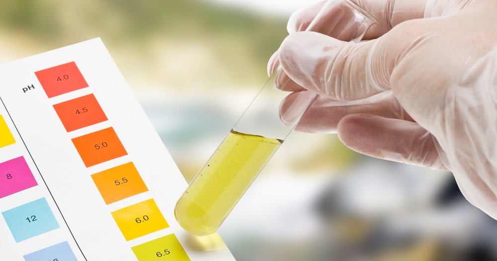Medical Laboratory and Biomedical Science Urine Test Can Measure