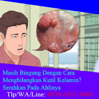 Obat Kutil Kelamin