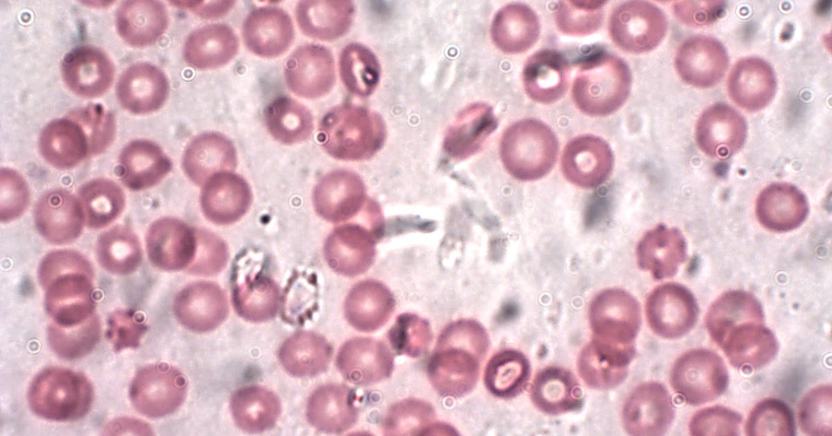 Detecting Red Blood Cell Damage in Realtime Science News