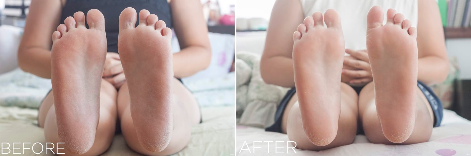 The Face Shop Smile Foot Peeling Before and After
