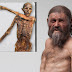 Ötzi, o conhecido "Iceman", utilizava recursos e conhecimentos sofisticados para tratar doenças