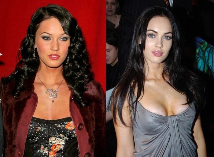 Megan Fox Plastic Surgery Before And After Botox Injection Breast.